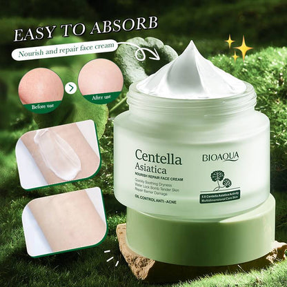 Crema Antiacné con Extracto de Centella Asiática (Face Cream Anti-Acne Centella Asiatica) – BIOAQUA
